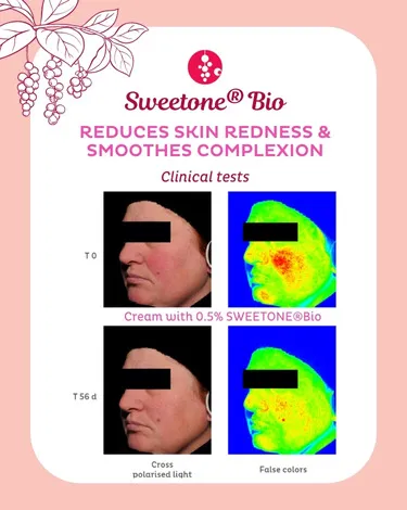Sweetone® Bio résultats cliniques