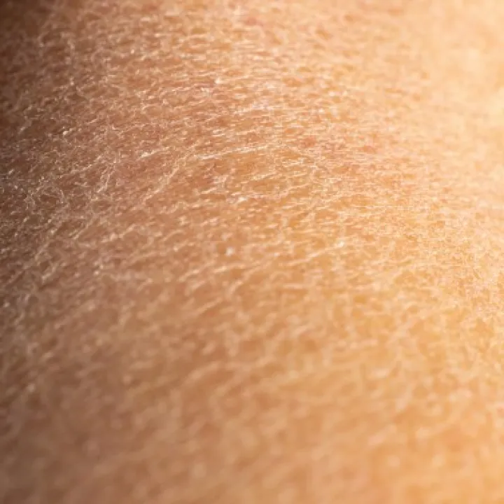 peau sèche