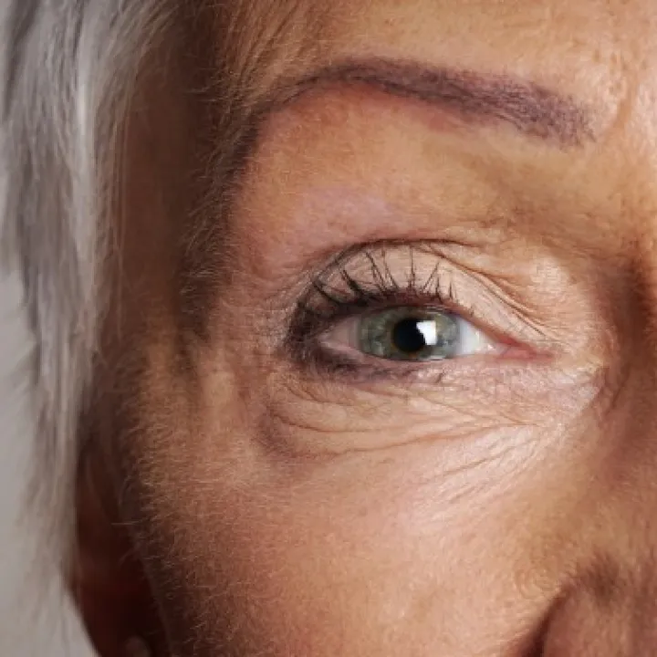 mature skin with wrinkles