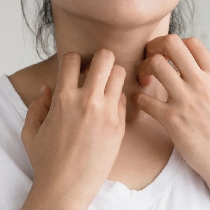 Sensitive itchy skin
