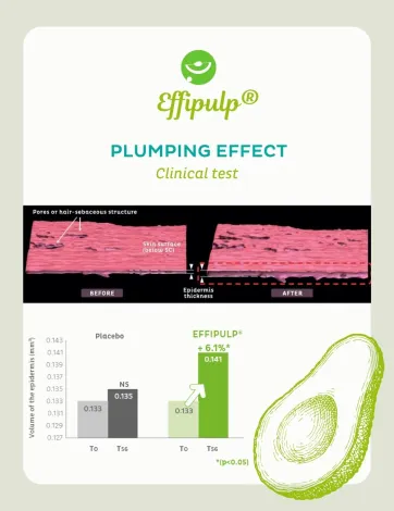 Résultats cliniques de Effipulp®