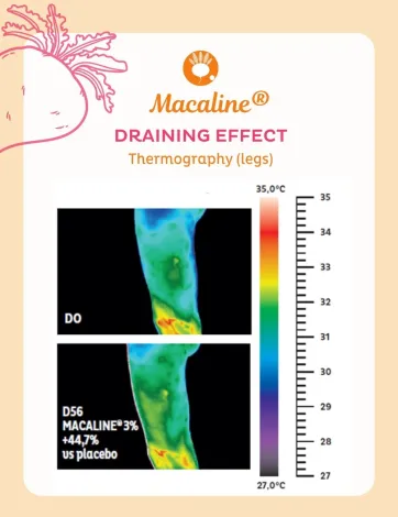 Résultats clinique Macaline®