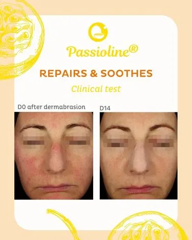 Résultats cliniques de Passioline®